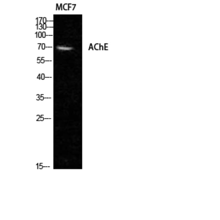 Western Blot - Anti-AChE Antibody (R12-2006) - Antibodies.com