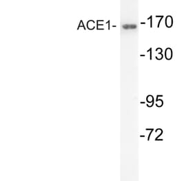 Western Blot - Anti-ACE1 Antibody (R12-2004) - Antibodies.com