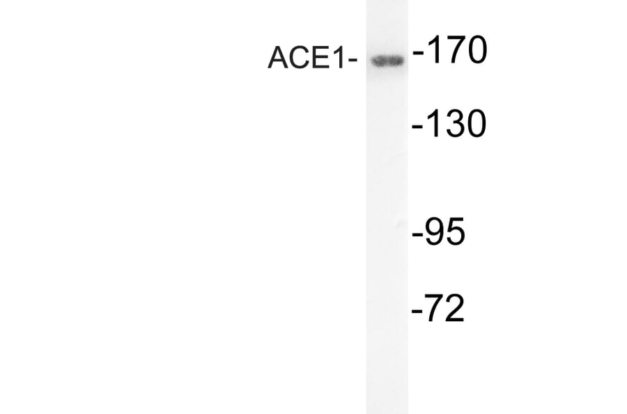 Western Blot - Anti-ACE1 Antibody (R12-2004) - Antibodies.com
