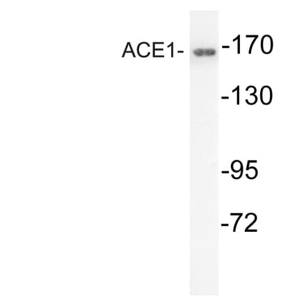 Western Blot - Anti-ACE1 Antibody (R12-2004) - Antibodies.com