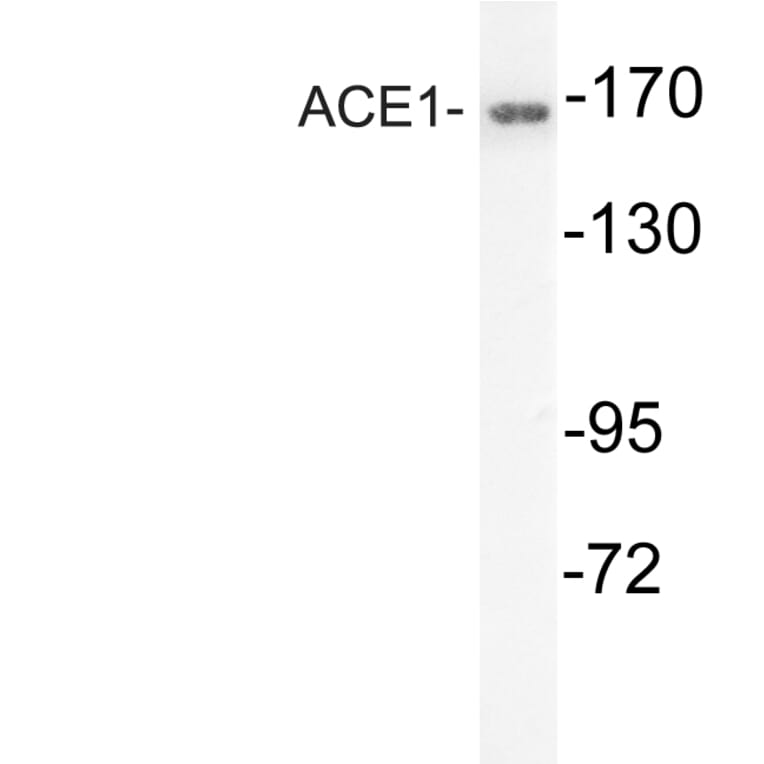Western Blot - Anti-ACE1 Antibody (R12-2004) - Antibodies.com