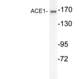 Western Blot - Anti-ACE1 Antibody (R12-2004) - Antibodies.com