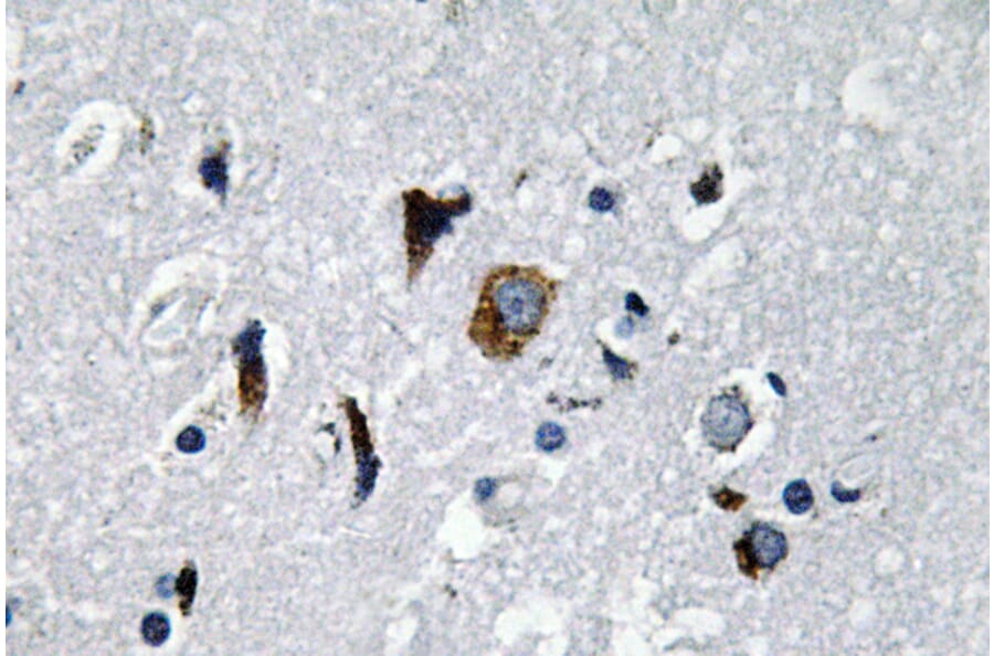 Immunohistochemistry - Anti-ACE1 Antibody (R12-2004) - Antibodies.com