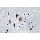 Immunohistochemistry - Anti-ACE1 Antibody (R12-2004) - Antibodies.com
