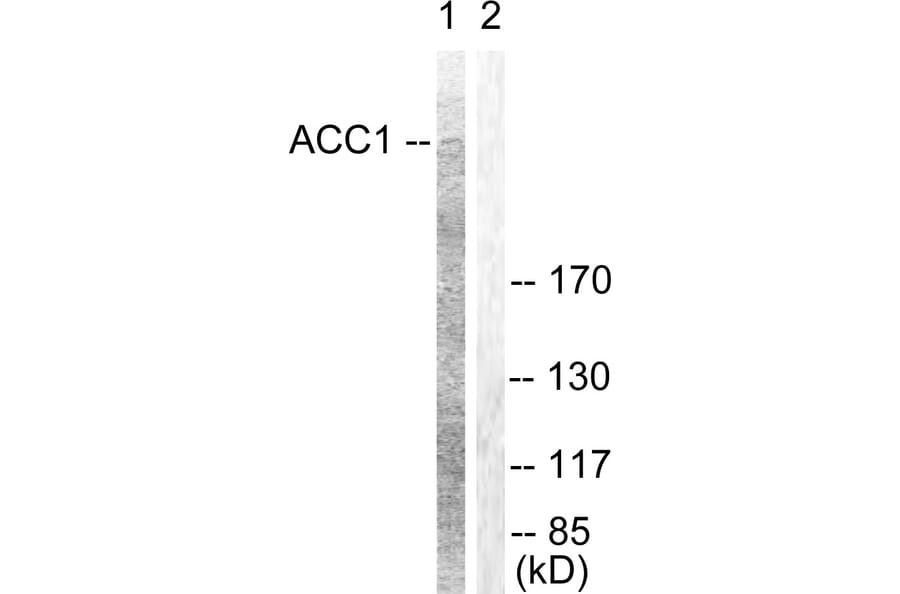 Western Blot - Anti-ACC1 Antibody (B0405) - Antibodies.com
