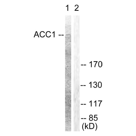 Western Blot - Anti-ACC1 Antibody (B0405) - Antibodies.com