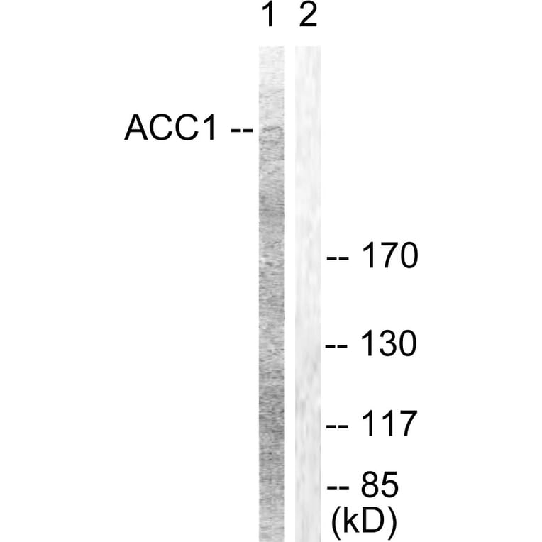 Western Blot - Anti-ACC1 Antibody (B0405) - Antibodies.com