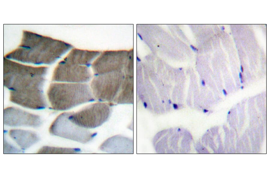 Immunohistochemistry - Anti-ACC1 Antibody (B0405) - Antibodies.com