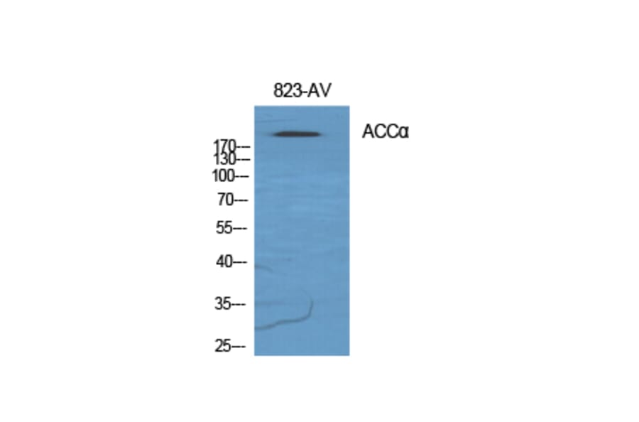 Western Blot - Anti-ACC1 Antibody (B0405) - Antibodies.com