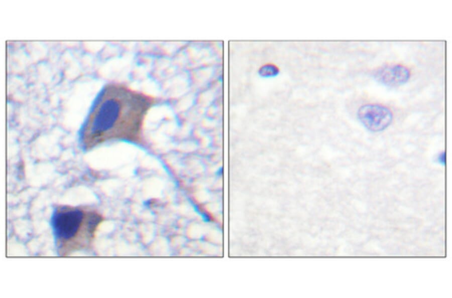 Immunohistochemistry - Anti-ACC1 Antibody (B0405) - Antibodies.com