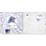 Immunohistochemistry - Anti-ACC1 Antibody (B0405) - Antibodies.com