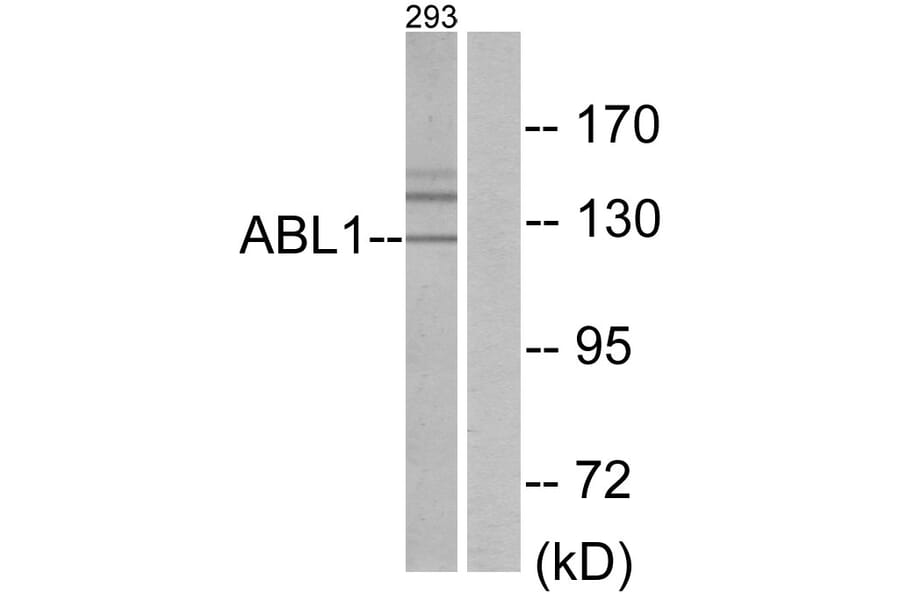Western Blot - Anti-ABL1 Antibody (C10256) - Antibodies.com