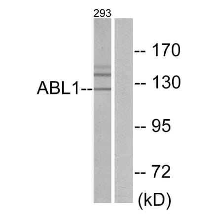 Western Blot - Anti-ABL1 Antibody (C10256) - Antibodies.com