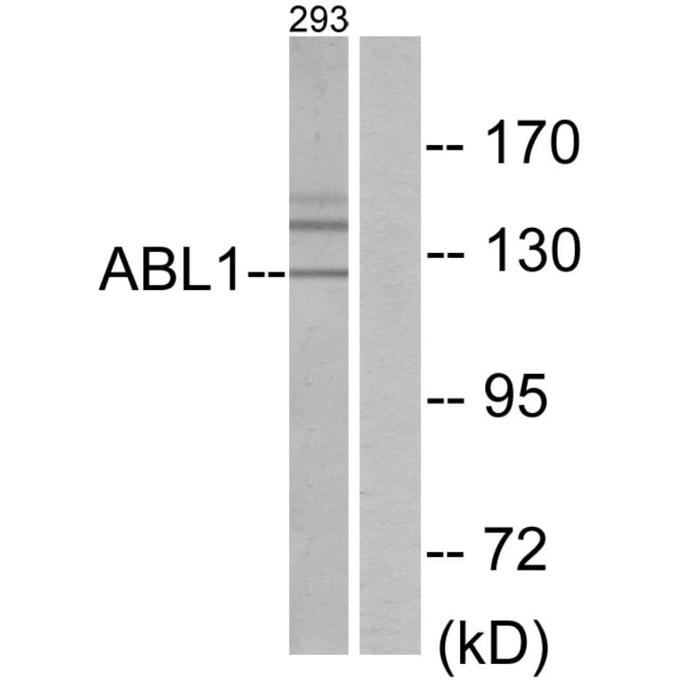 Western Blot - Anti-ABL1 Antibody (C10256) - Antibodies.com