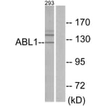 Western Blot - Anti-ABL1 Antibody (C10256) - Antibodies.com