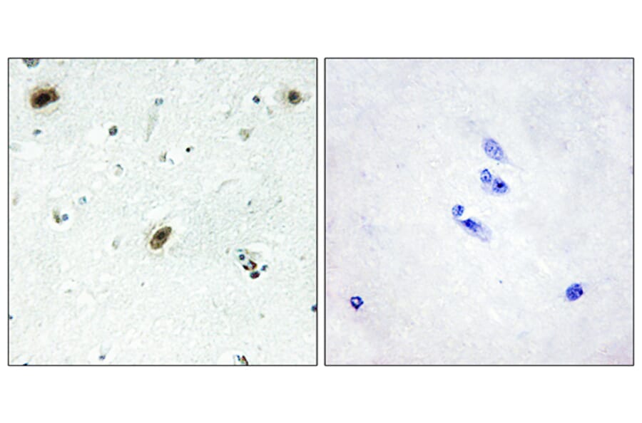 Immunohistochemistry - Anti-ABL1 Antibody (C10256) - Antibodies.com