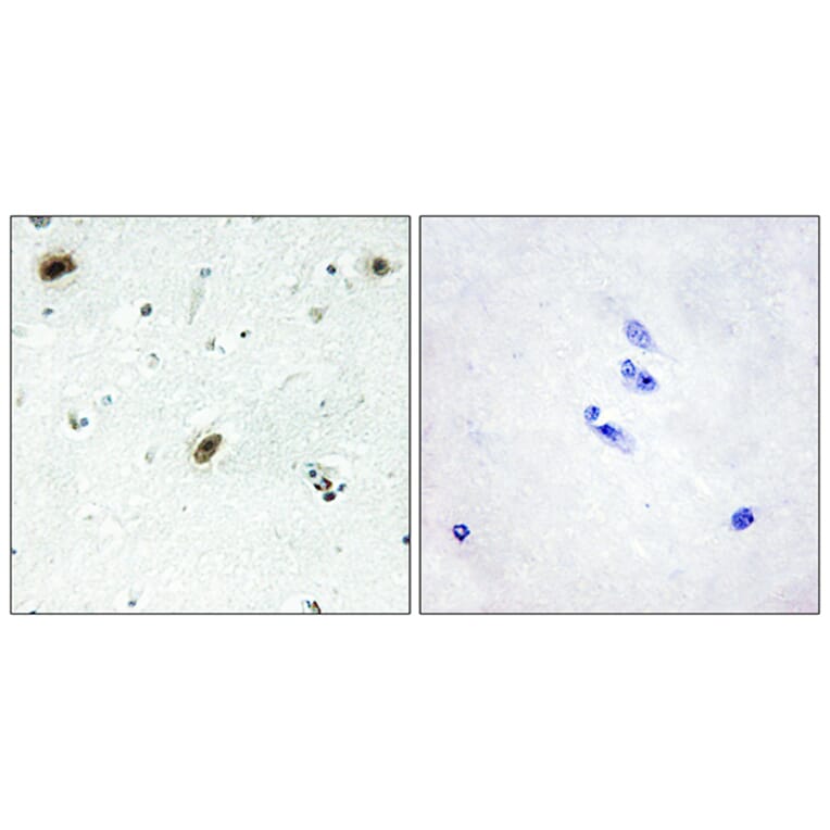 Immunohistochemistry - Anti-ABL1 Antibody (C10256) - Antibodies.com