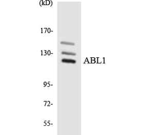 Western Blot - Anti-ABL1 Antibody (R12-2432) - Antibodies.com