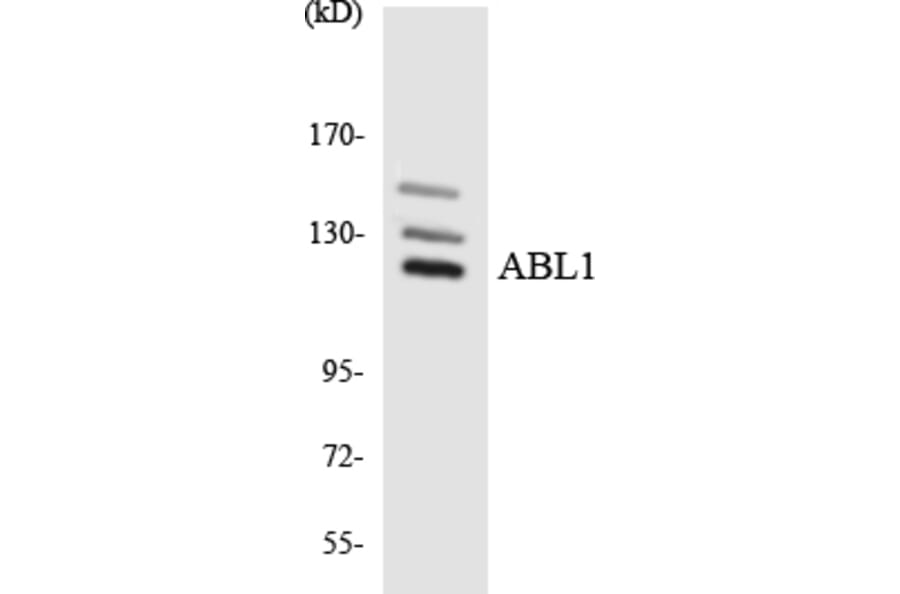 Western Blot - Anti-ABL1 Antibody (R12-2432) - Antibodies.com