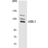 Western Blot - Anti-ABL1 Antibody (R12-2432) - Antibodies.com