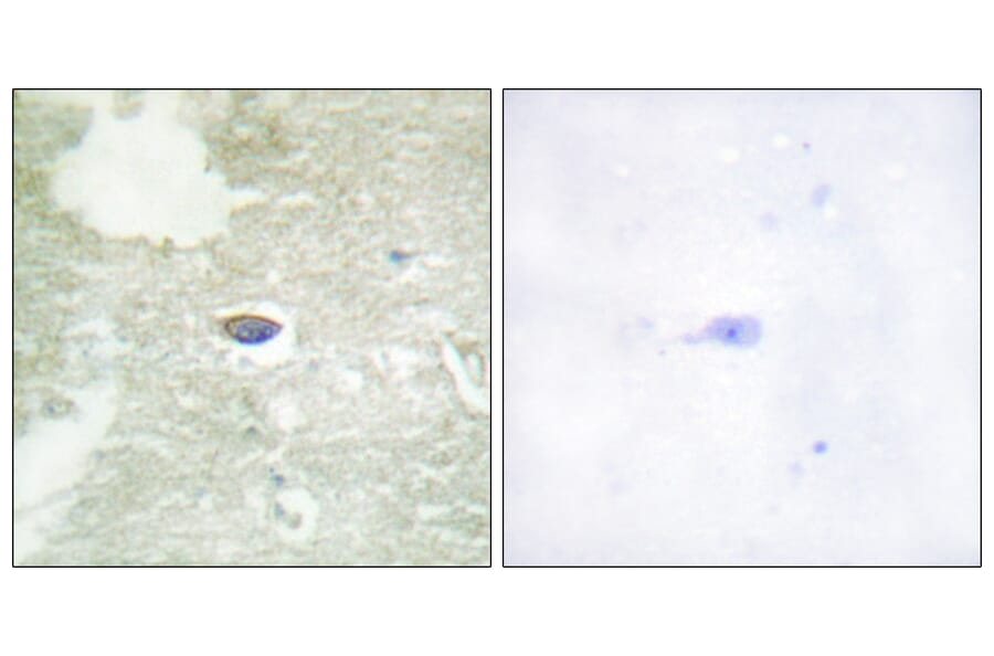 Immunohistochemistry - Anti-TGF beta Receptor II (phospho Ser225 + Ser250) Antibody (A1127) - Antibodies.com