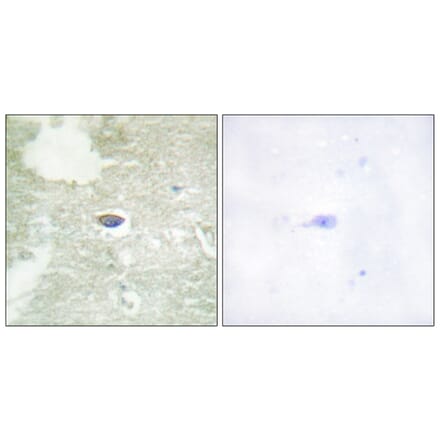 Immunohistochemistry - Anti-TGF beta Receptor II (phospho Ser225 + Ser250) Antibody (A1127) - Antibodies.com