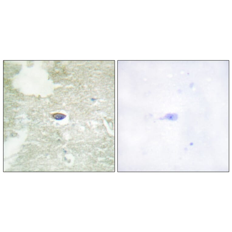 Immunohistochemistry - Anti-TGF beta Receptor II (phospho Ser225 + Ser250) Antibody (A1127) - Antibodies.com