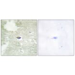 Immunohistochemistry - Anti-TGF beta Receptor II (phospho Ser225 + Ser250) Antibody (A1127) - Antibodies.com