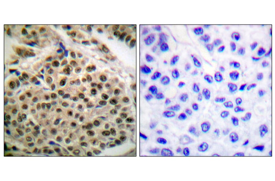 Immunohistochemistry - Anti-NF kappa B p105 / p50 (phospho Ser927) Antibody (A0021) - Antibodies.com