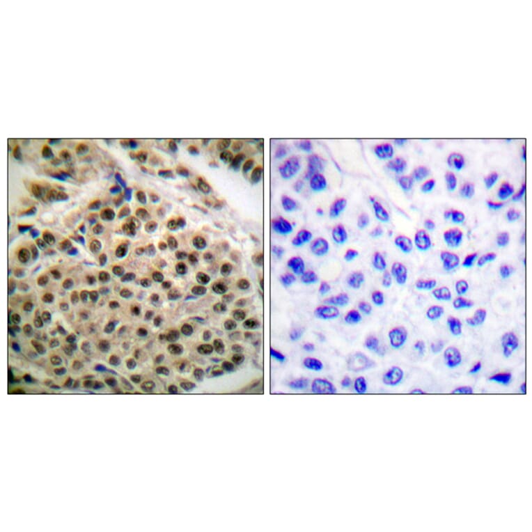 Immunohistochemistry - Anti-NF kappa B p105 / p50 (phospho Ser927) Antibody (A0021) - Antibodies.com