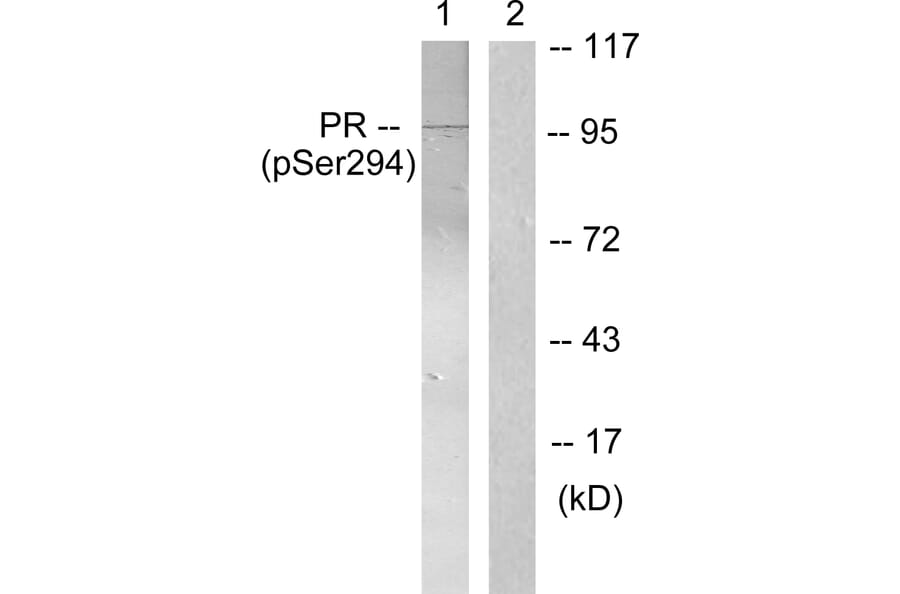Western Blot - Anti-Progesterone Receptor (phospho Ser294) Antibody (A0558) - Antibodies.com