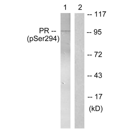 Western Blot - Anti-Progesterone Receptor (phospho Ser294) Antibody (A0558) - Antibodies.com