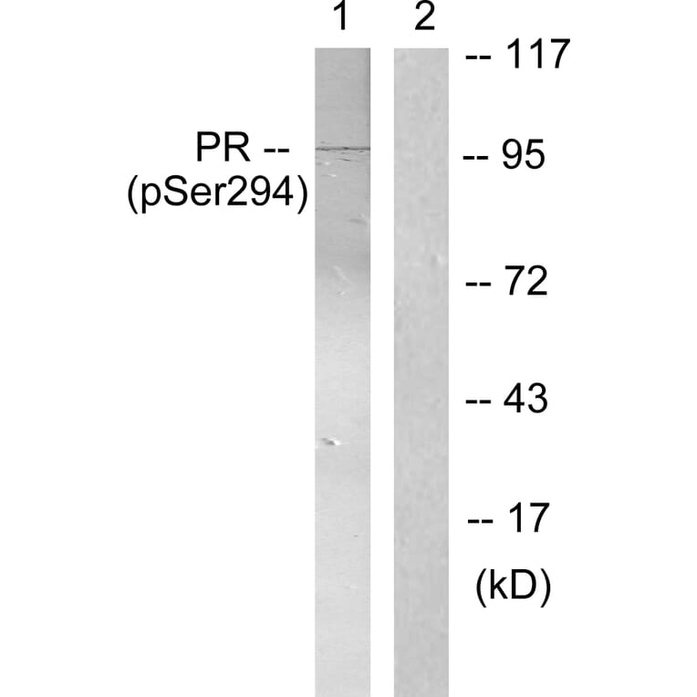 Western Blot - Anti-Progesterone Receptor (phospho Ser294) Antibody (A0558) - Antibodies.com