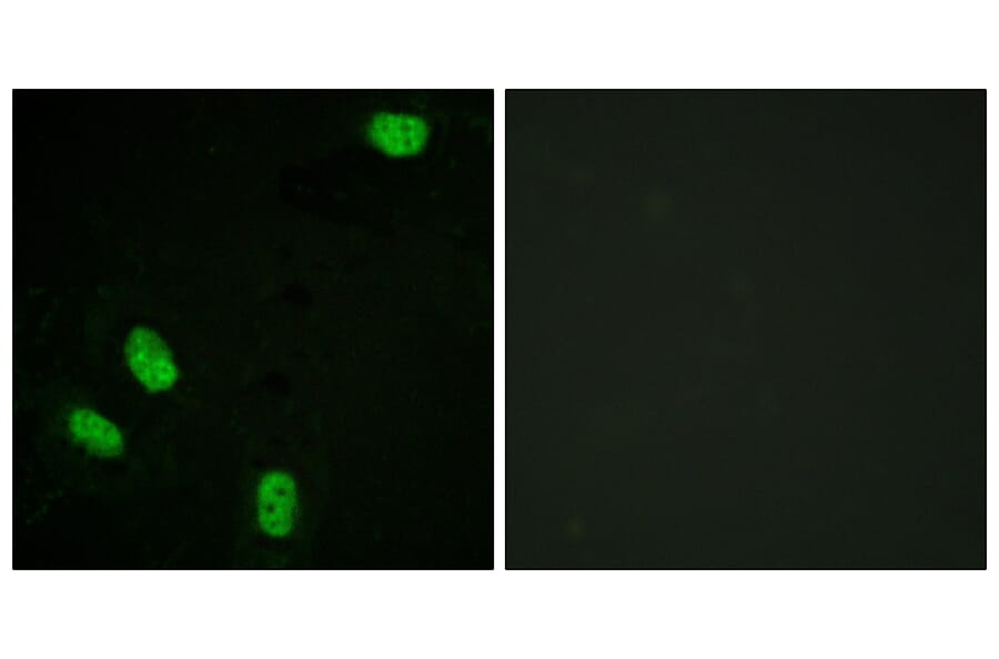 Immunofluorescence - Anti-Progesterone Receptor (phospho Ser294) Antibody (A0558) - Antibodies.com
