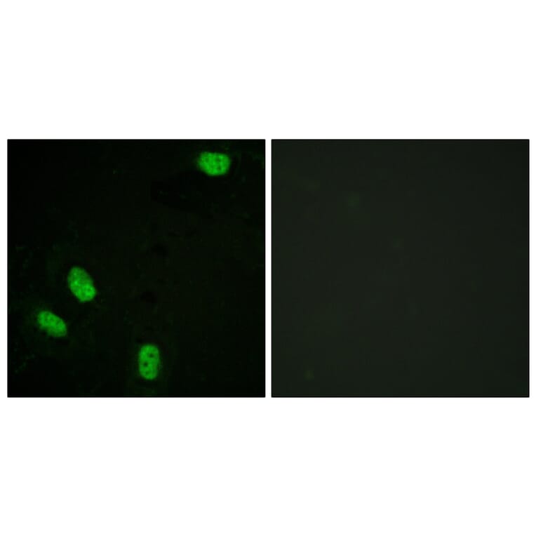 Immunofluorescence - Anti-Progesterone Receptor (phospho Ser294) Antibody (A0558) - Antibodies.com