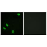Immunofluorescence - Anti-Progesterone Receptor (phospho Ser294) Antibody (A0558) - Antibodies.com