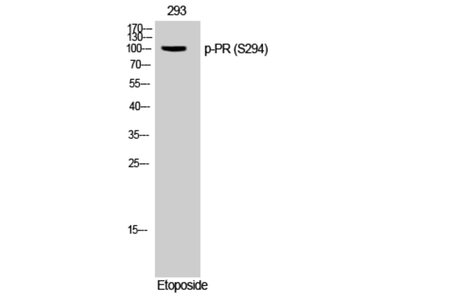 Western Blot - Anti-Progesterone Receptor (phospho Ser294) Antibody (A0558) - Antibodies.com