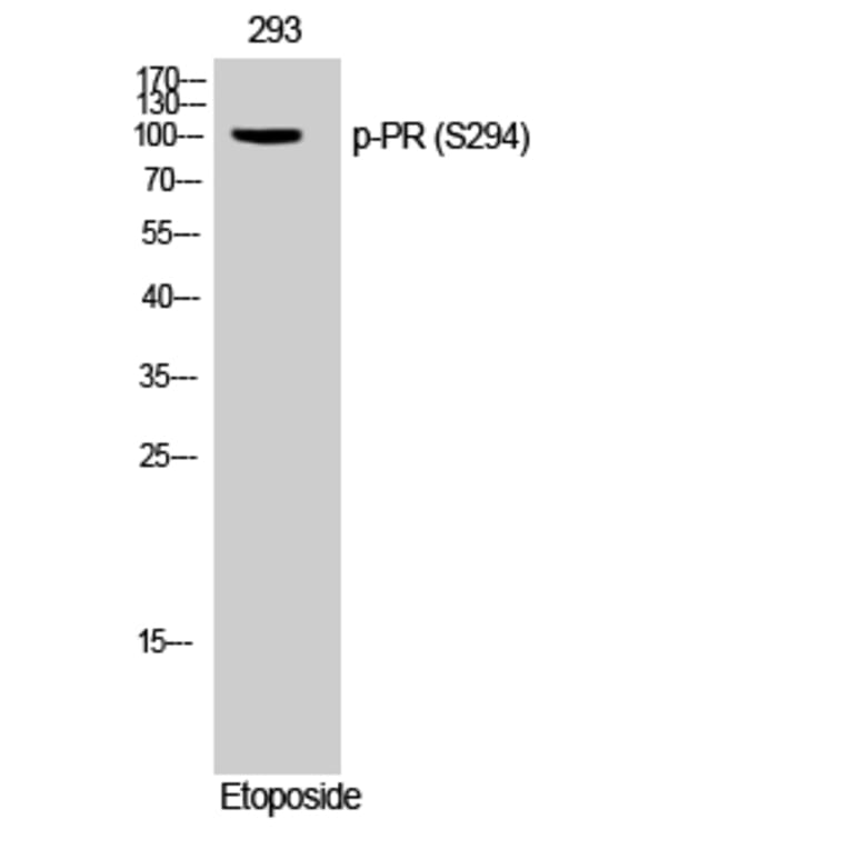 Western Blot - Anti-Progesterone Receptor (phospho Ser294) Antibody (A0558) - Antibodies.com