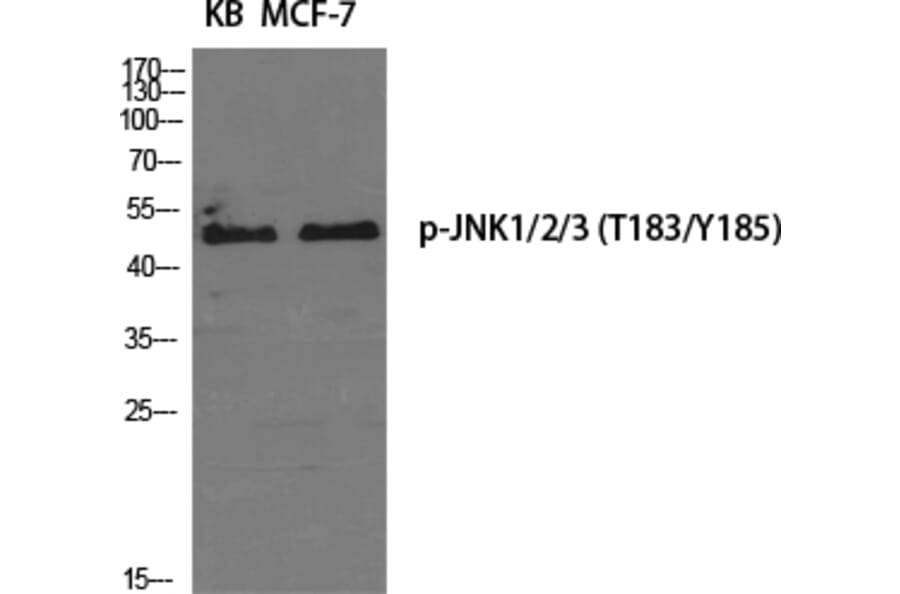 Western Blot - Anti-JNK1 + JNK2 + JNK3 (phospho Thr183+Tyr185) Antibody (A0500) - Antibodies.com
