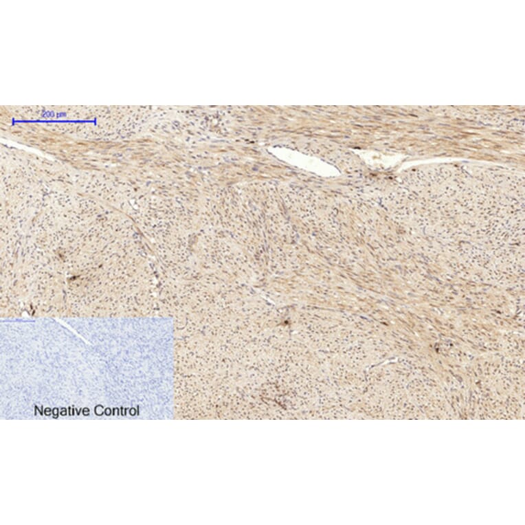 Immunohistochemistry - Anti-JNK1 + JNK2 + JNK3 (phospho Thr183+Tyr185) Antibody (A0500) - Antibodies.com