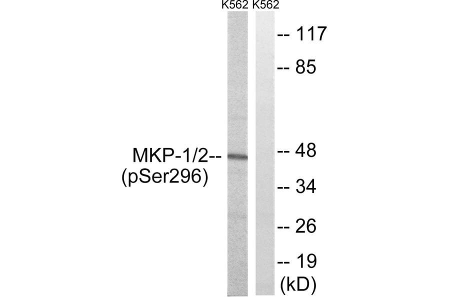 Western Blot - Anti-MKP1 + MKP2 (phospho Ser296 + Ser318) Antibody (A8372) - Antibodies.com