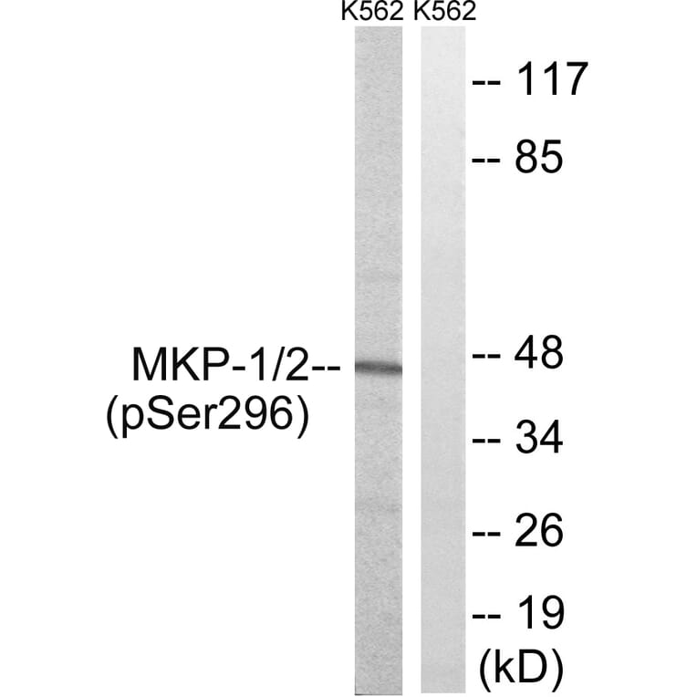 Western Blot - Anti-MKP1 + MKP2 (phospho Ser296 + Ser318) Antibody (A8372) - Antibodies.com