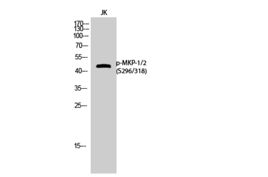 Western Blot - Anti-MKP1 + MKP2 (phospho Ser296 + Ser318) Antibody (A8372) - Antibodies.com