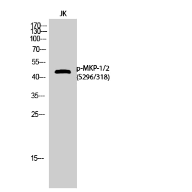 Western Blot - Anti-MKP1 + MKP2 (phospho Ser296 + Ser318) Antibody (A8372) - Antibodies.com