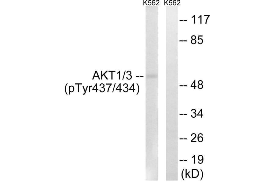 Western Blot - Anti-AKT1 + AKT3 (phospho Tyr437 + Tyr434) Antibody (A8076) - Antibodies.com
