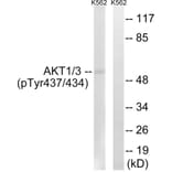 Western Blot - Anti-AKT1 + AKT3 (phospho Tyr437 + Tyr434) Antibody (A8076) - Antibodies.com