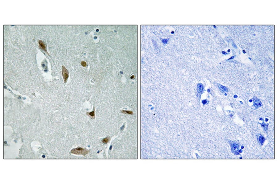 Immunohistochemistry - Anti-AKT1 + AKT3 (phospho Tyr437 + Tyr434) Antibody (A8076) - Antibodies.com