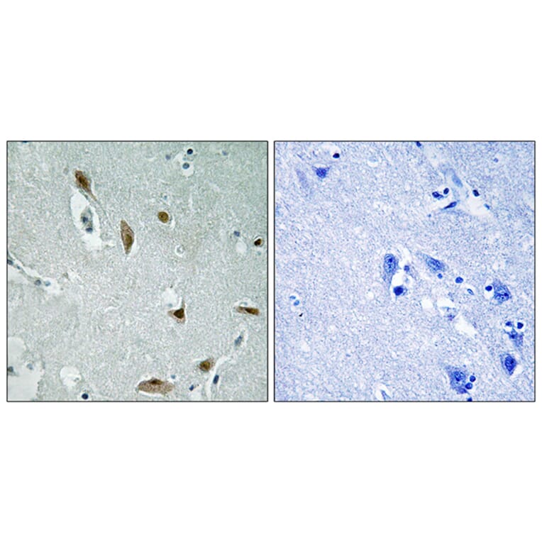Immunohistochemistry - Anti-AKT1 + AKT3 (phospho Tyr437 + Tyr434) Antibody (A8076) - Antibodies.com