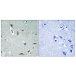 Immunohistochemistry - Anti-AKT1 + AKT3 (phospho Tyr437 + Tyr434) Antibody (A8076) - Antibodies.com