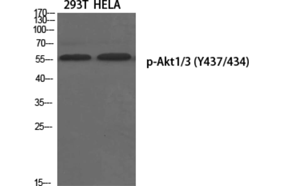 Western Blot - Anti-AKT1 + AKT3 (phospho Tyr437 + Tyr434) Antibody (A8076) - Antibodies.com